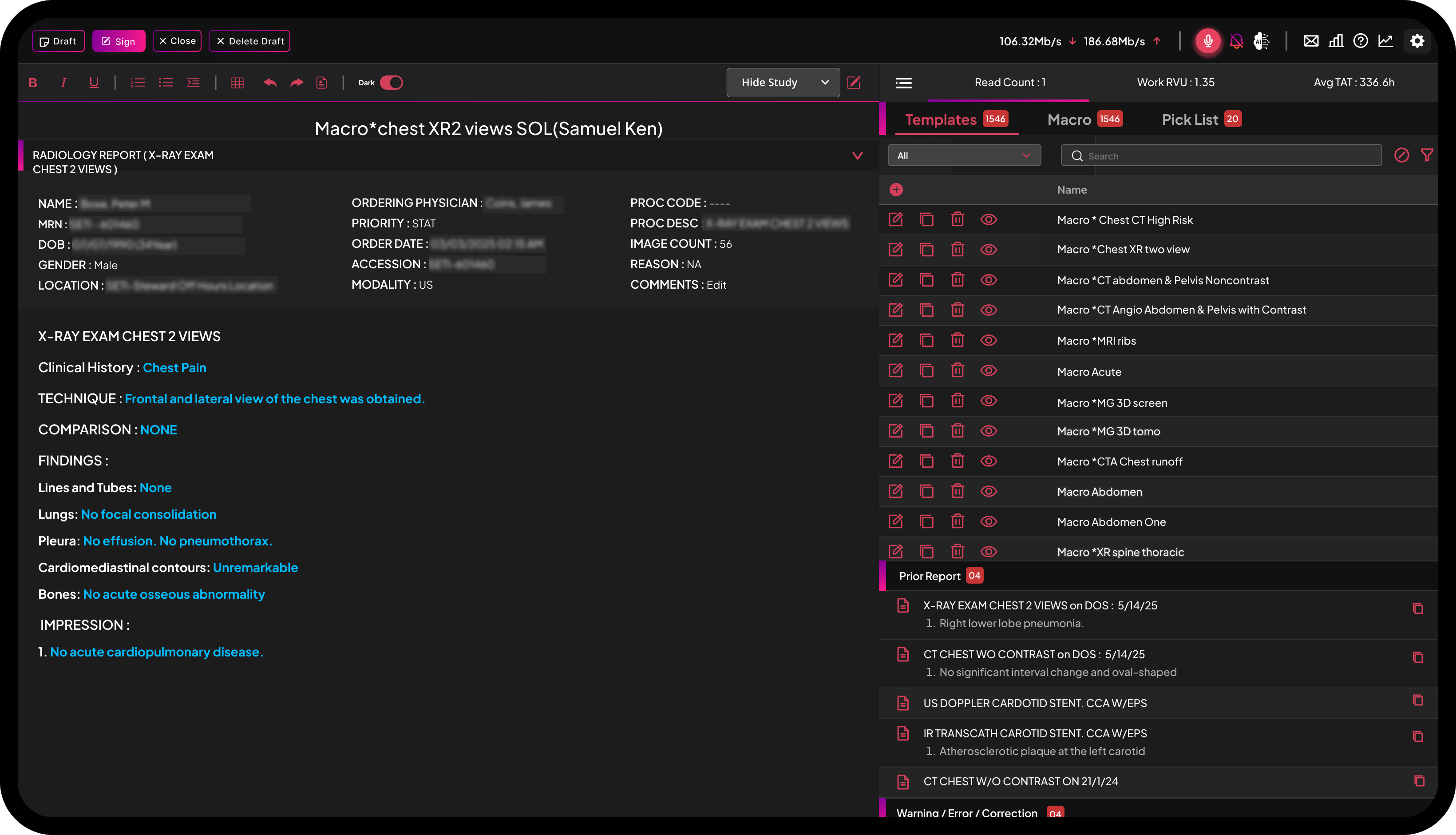 product_asr_2_1600x900